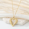 Open Heart